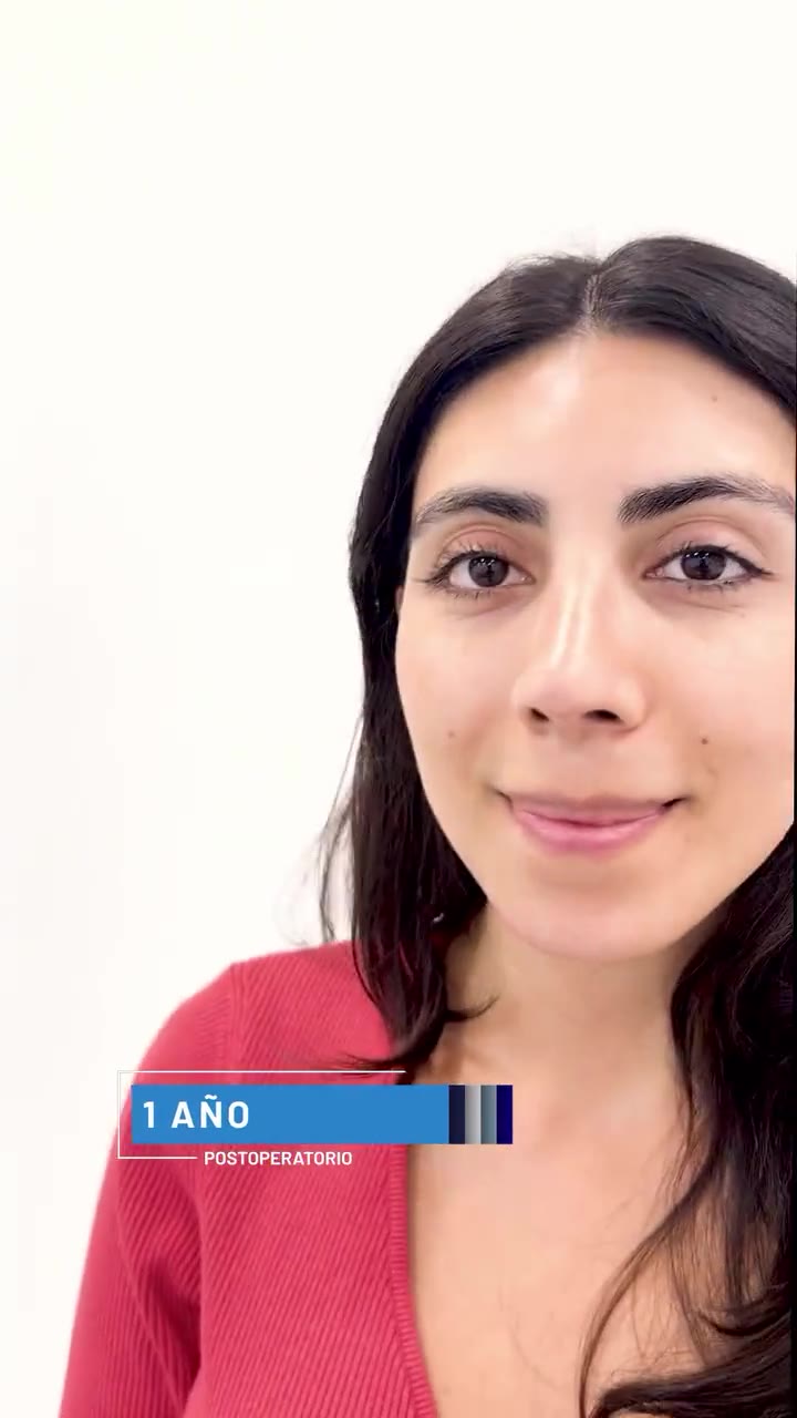 Evolución de una paciente a 1 año